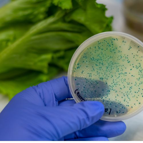 Is E. coli in urine contagious