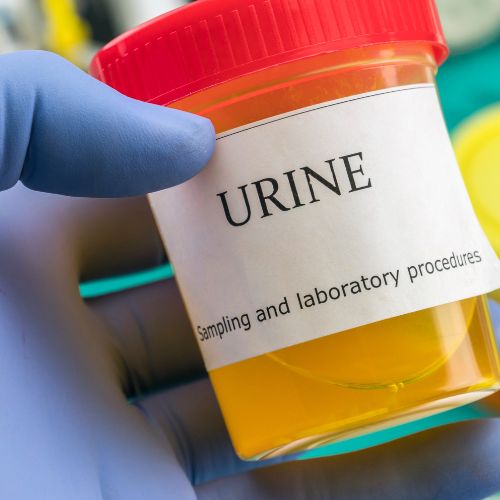 what does blood in urine look like?