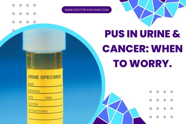 Pus in Urine & Cancer: When to worry.