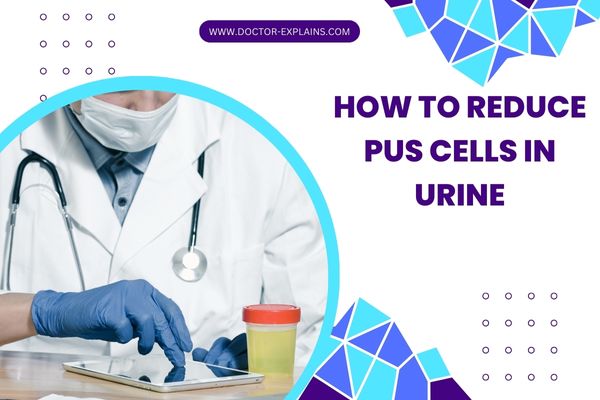 9 Best Remedies to Reduce Pus Cells in Urine